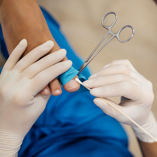 cirugia ungueal