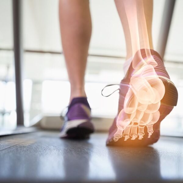 Estudio de la pisada