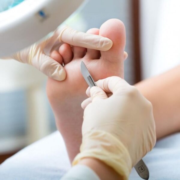 Cirugía podología orihuela